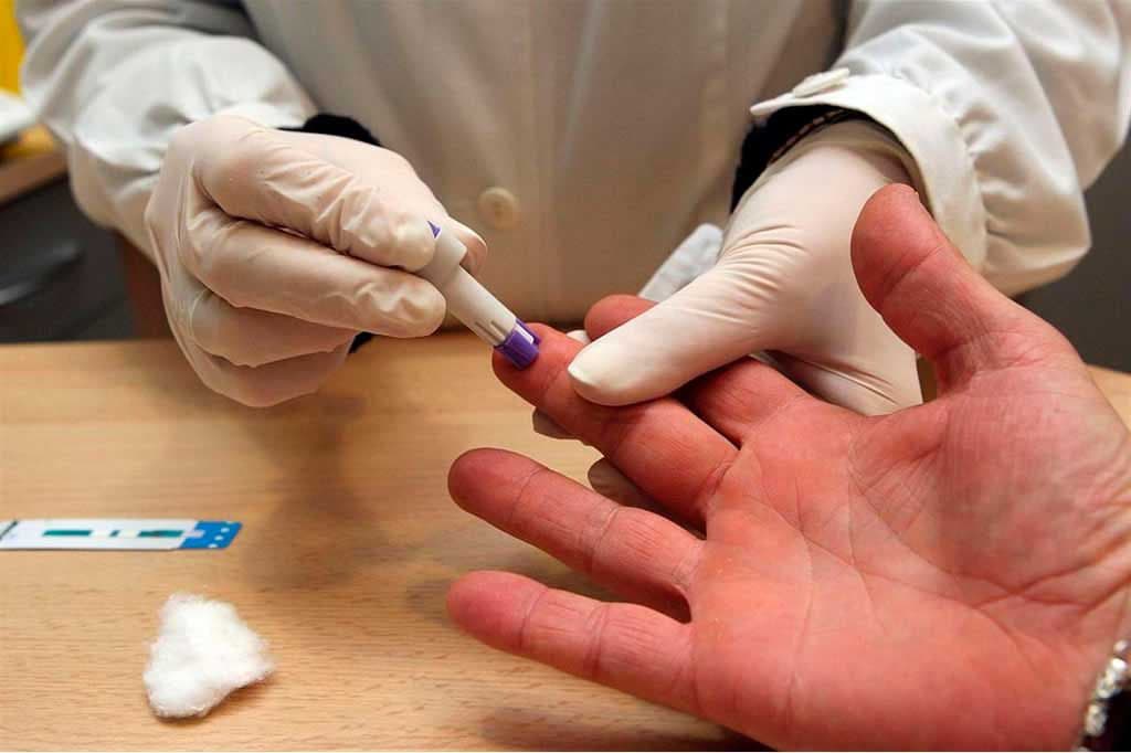 Afirman que un paciente con VIH podría recuperarse por primera vez con medicamentos antivirales