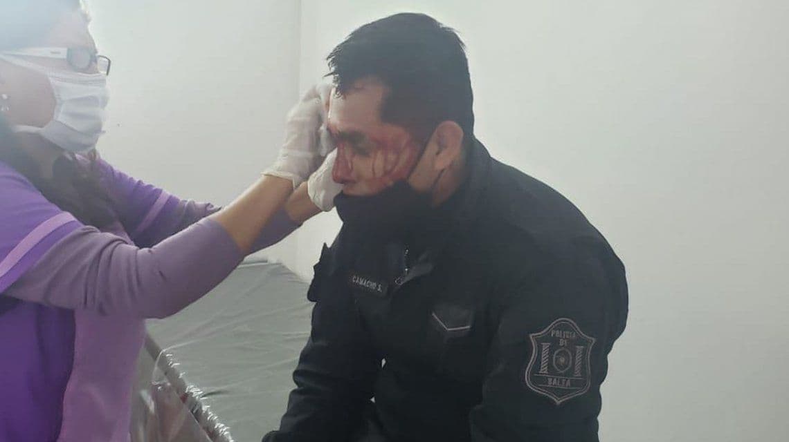 Brutal ataque a policías por detener un picadito ilegal
