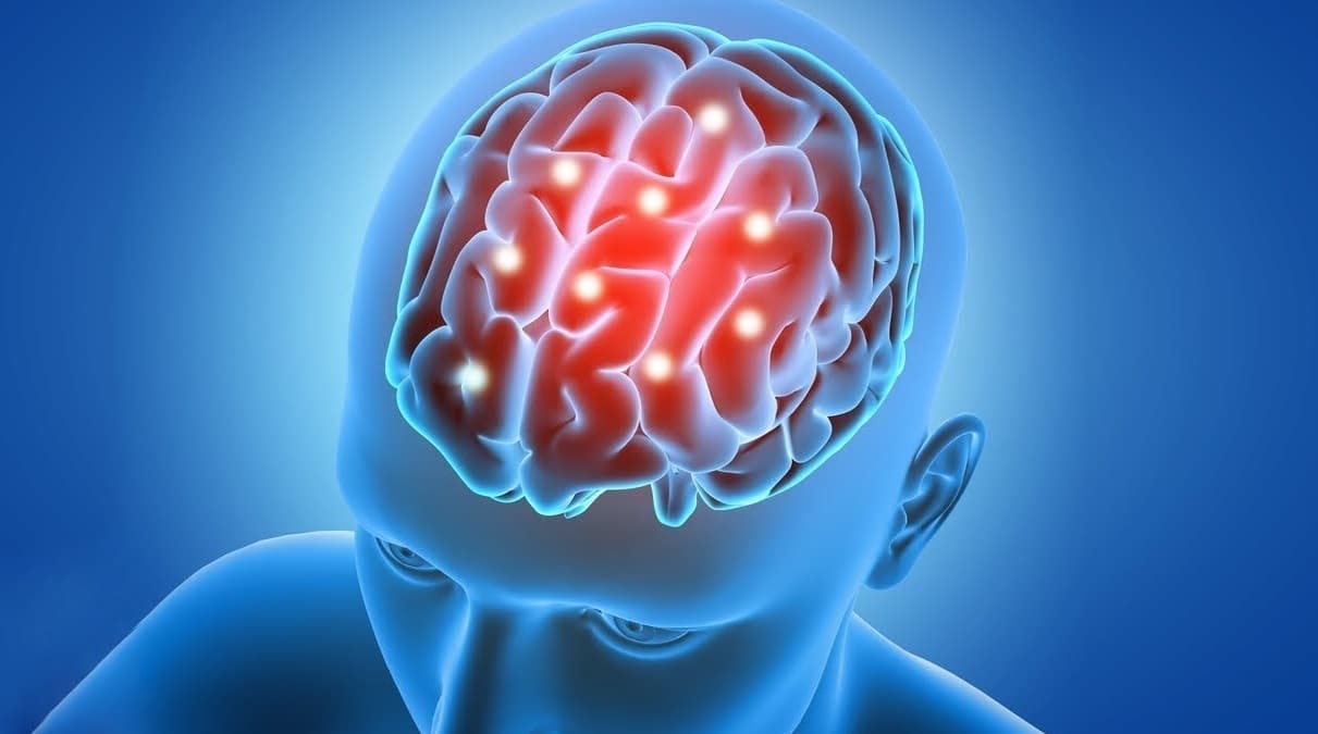 Un fármaco experimental retrasó hasta 60% la progresión del Alzheimer en su fase temprana