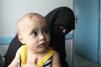 En Yemen, cada diez minutos muere un niño menor de cinco años