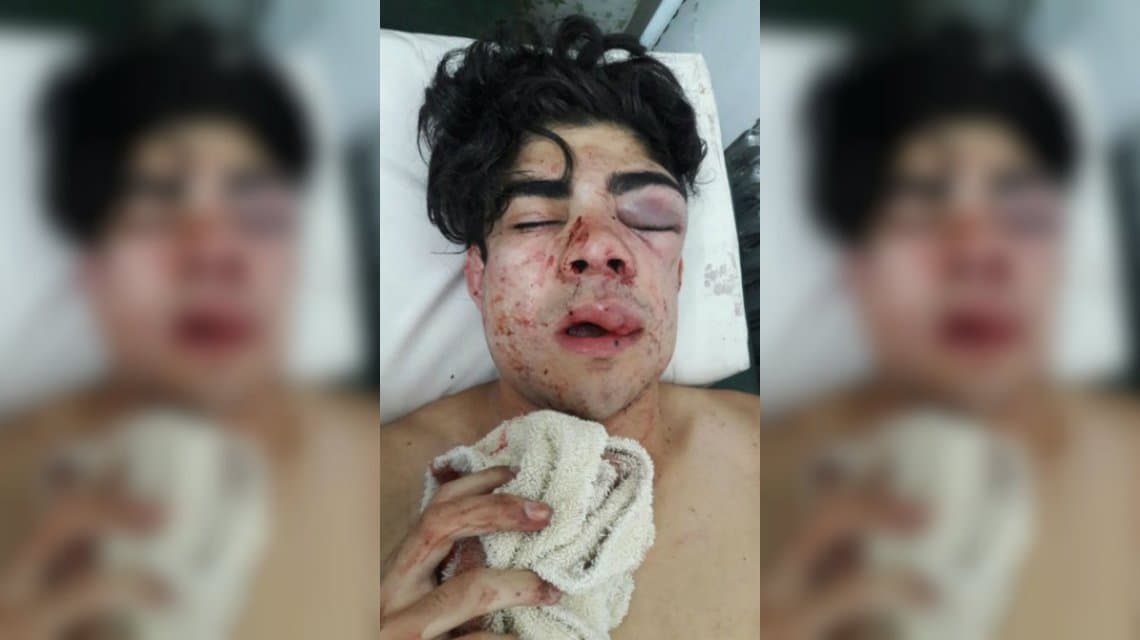 La desgarradora carta de la mamá del chico atacado por su tonada chilena
