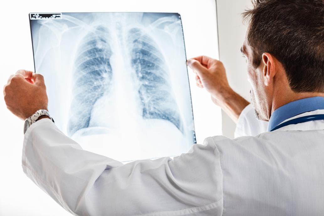 Las máquinas empiezan a ganar a los humanos en la predicción del riesgo de cáncer