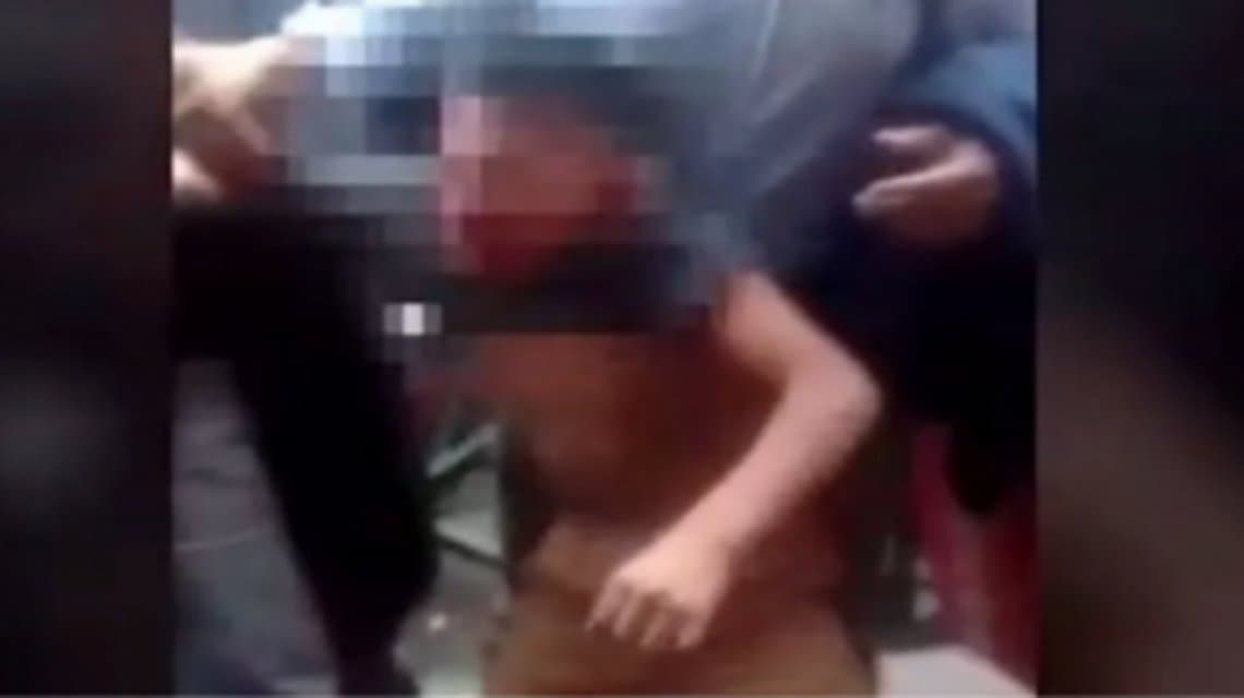 Indignante: un nene gastó 20 pesos en golosinas y su mamá le fracturó el cráneo con un machete