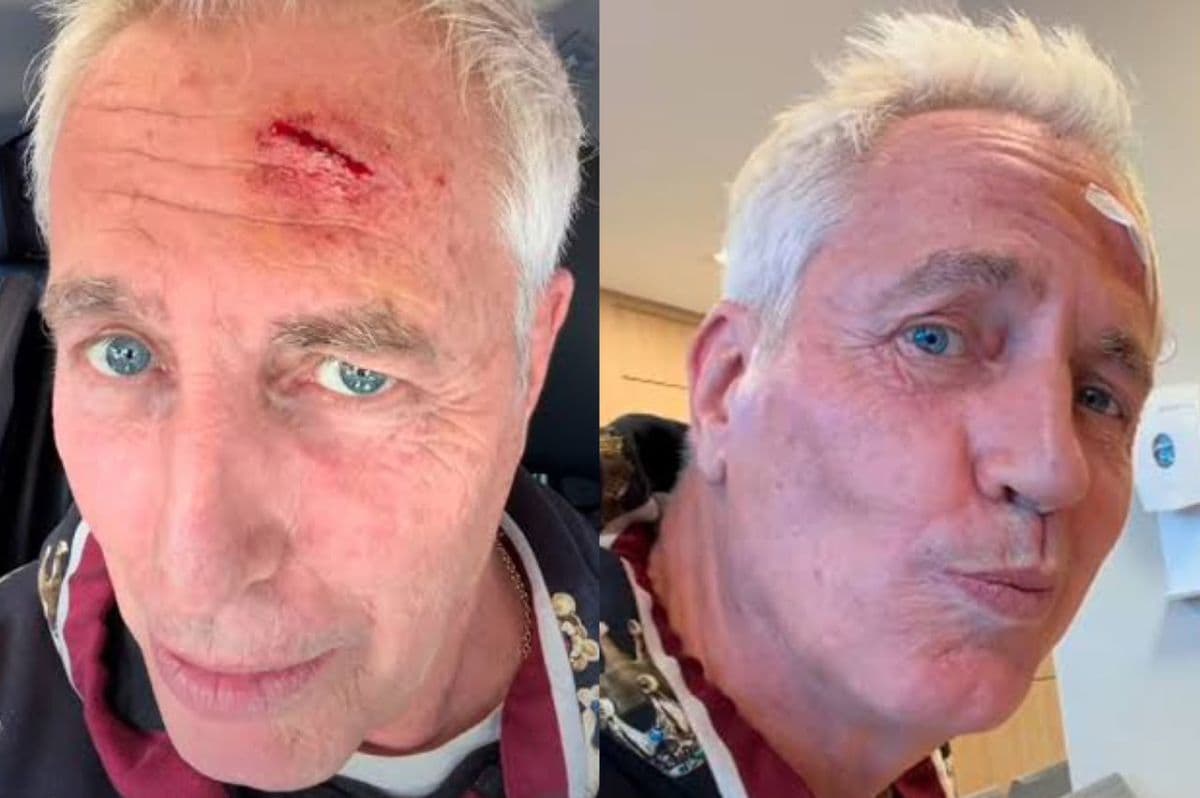 Marley sufrió un tremendo golpe y terminó en el hospital: "Premio al bolu... del año"