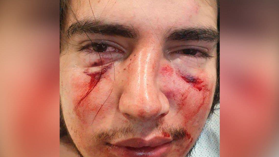 El comunicado de la UAR tras la brutal golpiza de un grupo de rugbiers a un joven en Córdoba