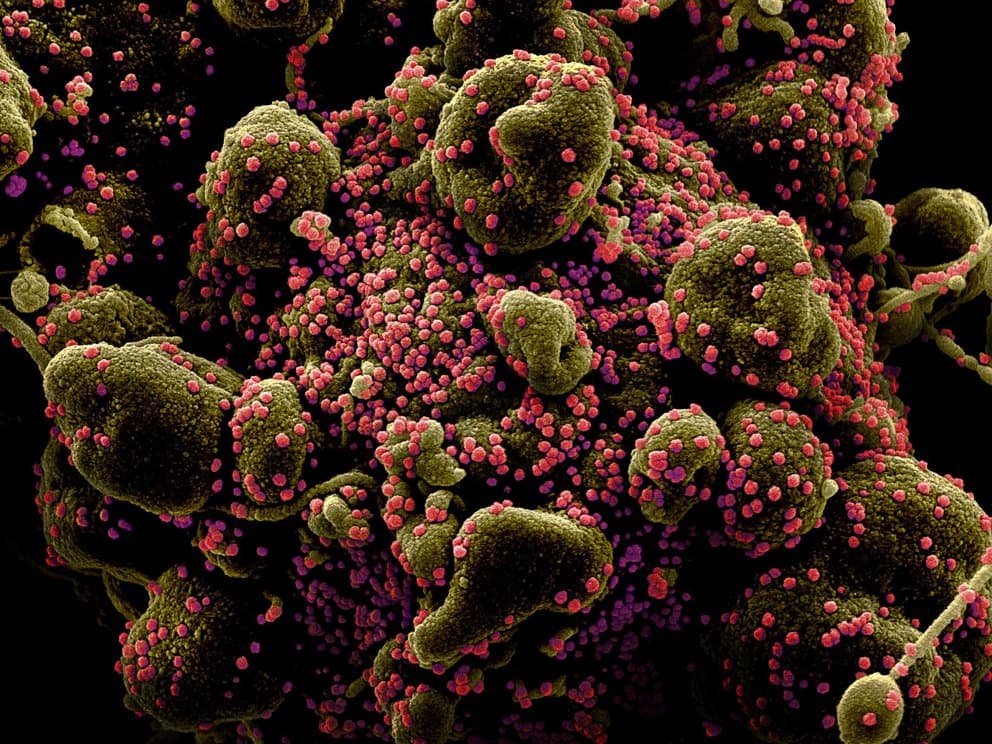 COVID-19: advierten que una persona puede infectarse con dos variantes al mismo tiempo