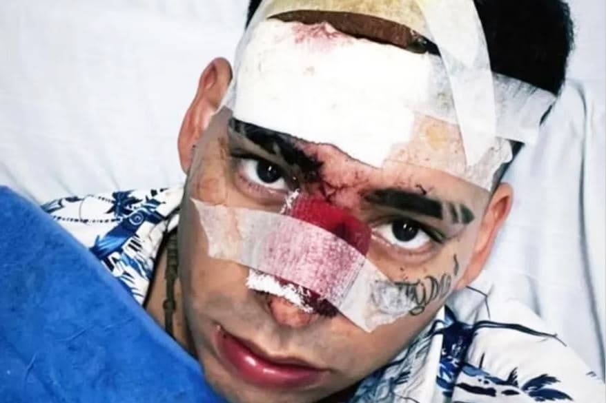 Kaleb Di Masi chocó contra un patrullero en la Autopista del Oeste y sufrió serias heridas: se investiga si corría picadas