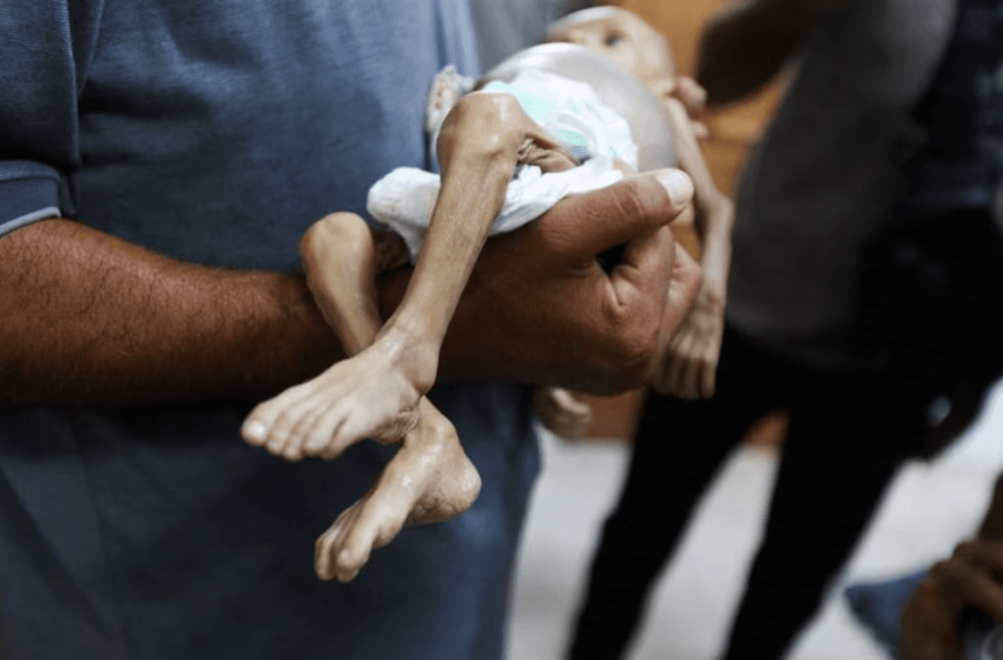 El hambre azota a los hospitales de Gaza: no hay alimentos, las enfermeras se desmayan y escasea la leche para bebés
