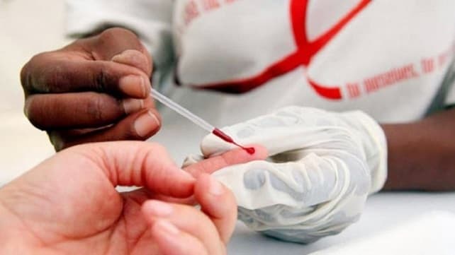 Detectan una variante del VIH que desarrolla más rápido el sida