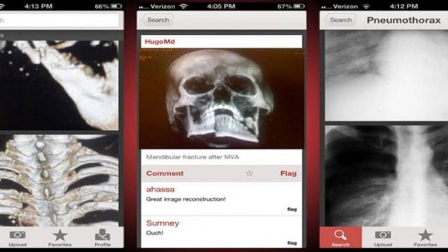 Crean una plataforma para subir imágenes de diagnóstico médico
