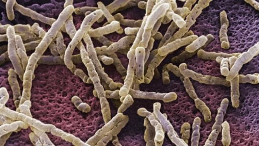 Ordenaron sacar del mercado dos alimentos contaminados