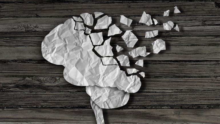 ¿Qué pasa con el cerebro cuando no se hace actividad física?