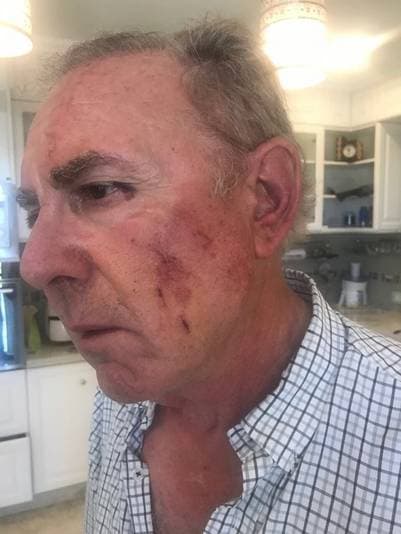 Brutal asalto al empresario agropecuario Carlos Garetto en su casa