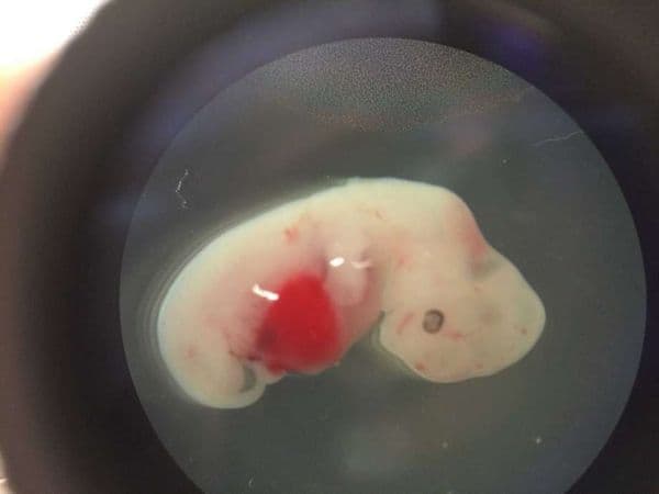 Ciencia: crean embriones híbridos de humanos y cerdos