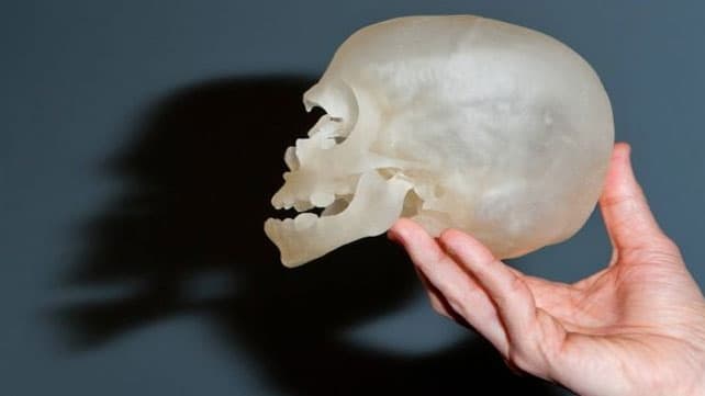 Un rostro nuevo para Violet gracias a una impresora 3D