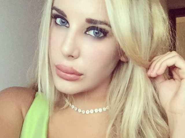 Nuevas fotos de Charlotte con moretones