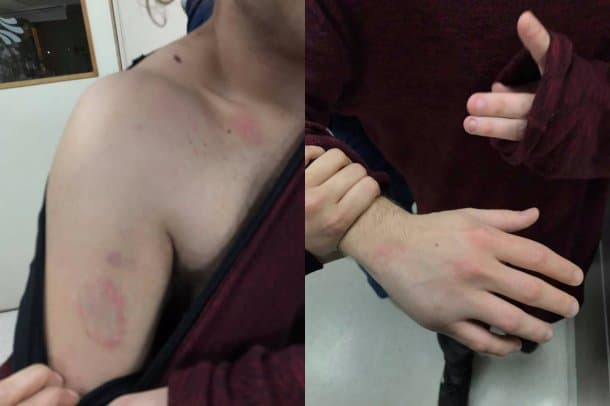 Patovicas golpearon a una chica y su novio a la salida de un boliche de la Costanera