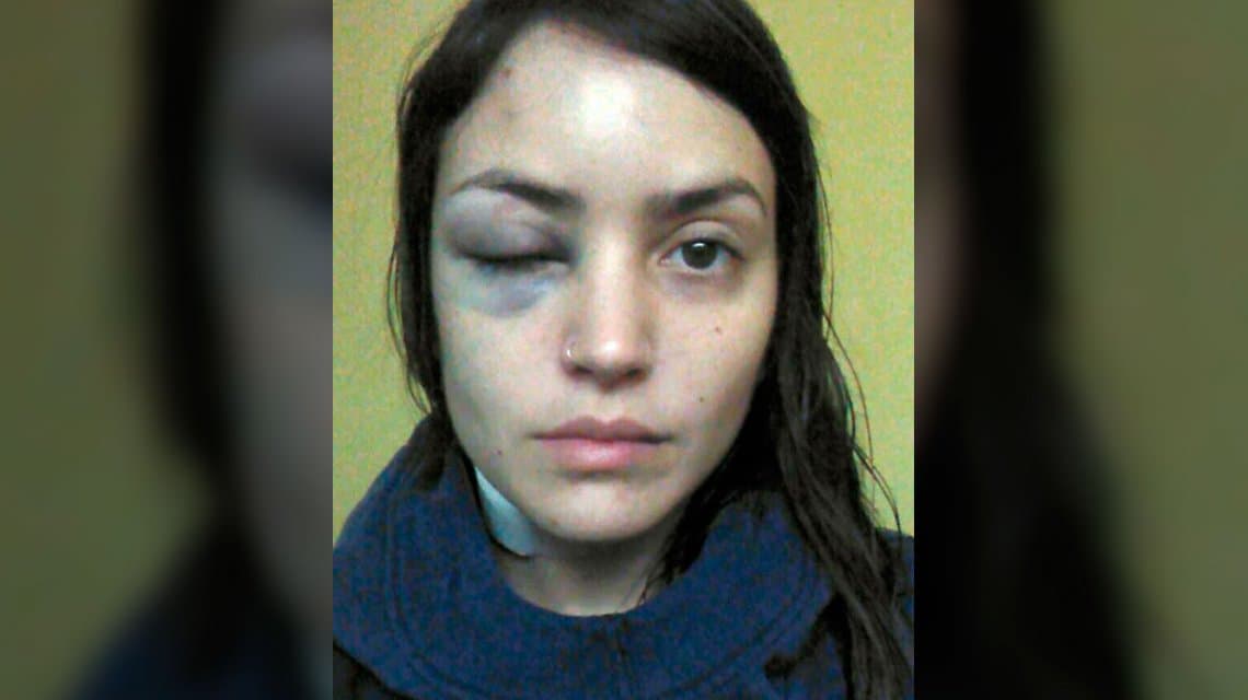 Una joven denunció que un hombre le dio una brutal golpiza en pleno centro porteño