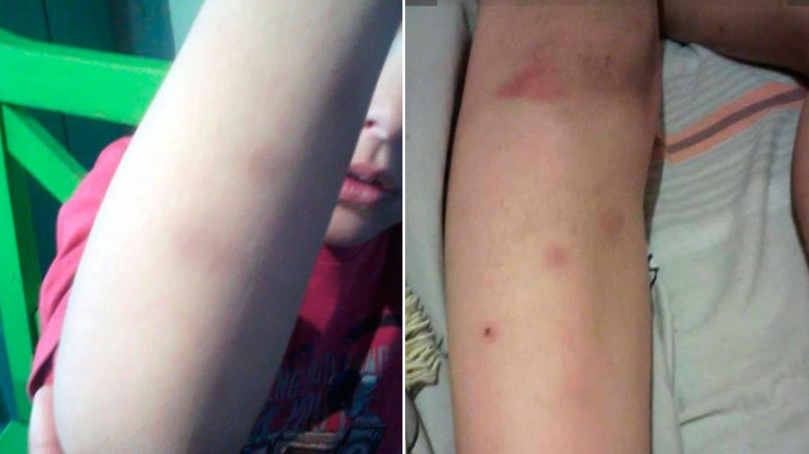 Denuncian que alumnos golpearon a un compañerito con hiperactividad