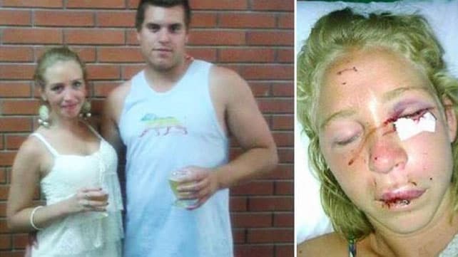 Le dio una paliza a su ex novia por cómo bailaba en una fiesta