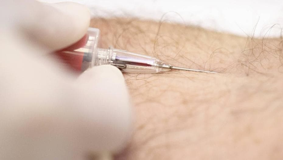 Alerta hepatitis: advierten por nuevos casos del tipo A y B en el país