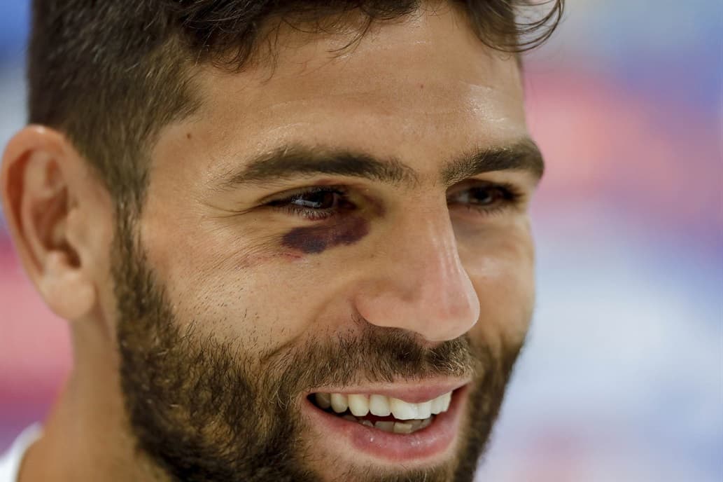 La explicación y la broma de Federico Fazio: por qué apareció con el ojo morado en la conferencia