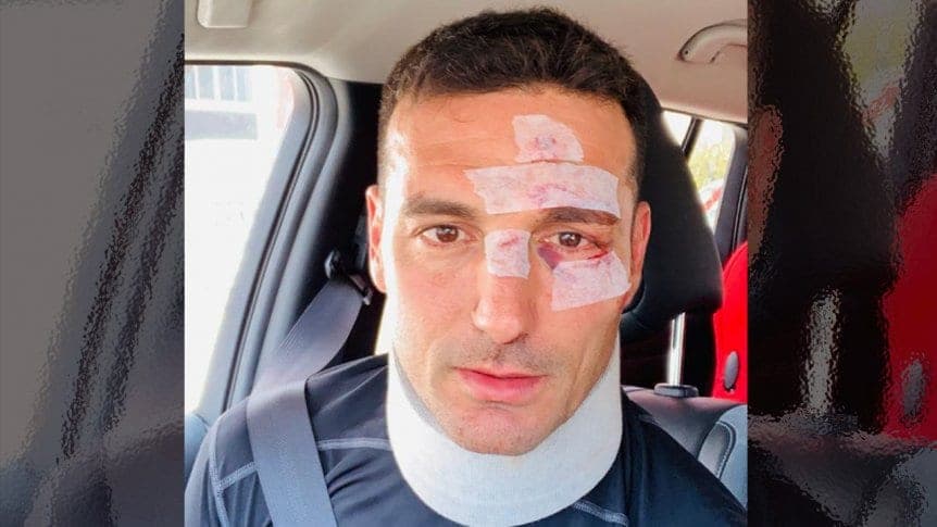 Dan de alta a Lionel Scaloni