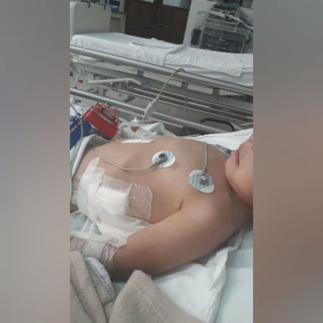 Dos dogos y un pitbull atacaron a un nene de tres años y lo dejaron internado