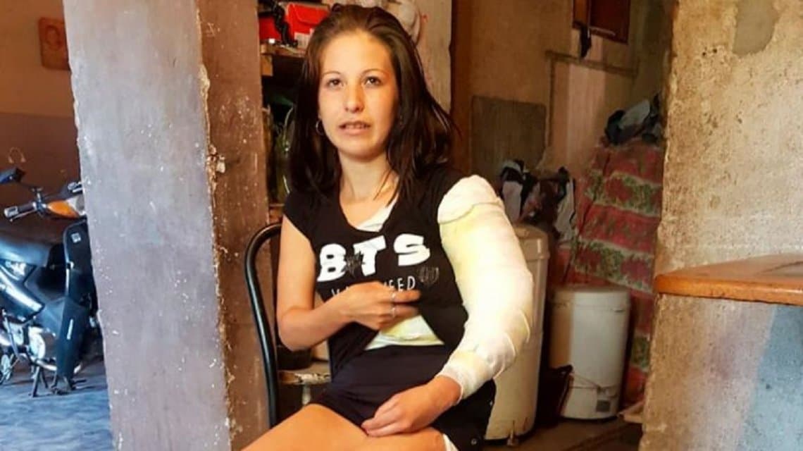 «Me prendió fuego y se reía, pensé que me iba a morir»: el drama de Naomí, víctima de violencia de género