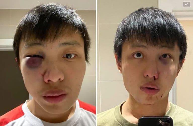 Brutal ataque racista a un joven asiático en Londres: «No quiero tu coronavirus en mi país»