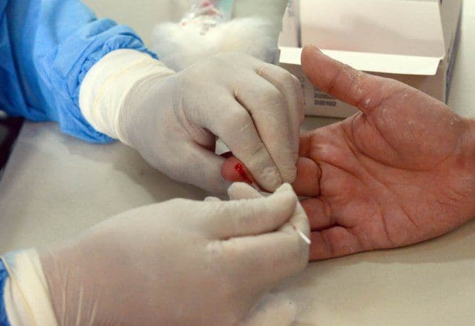 Gobierno presenta test rápidos diseñados por el Conicet para detectar el Covid-19